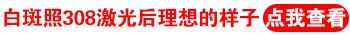 白斑病皮肤容易发痒吗